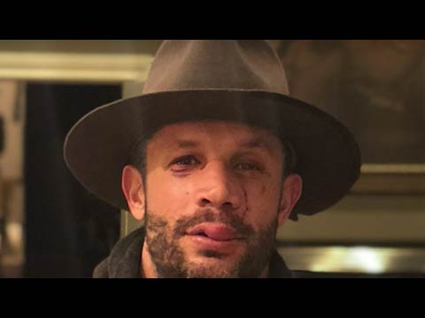 Cure or Blessing? Aubrey Marcus Car Wreck